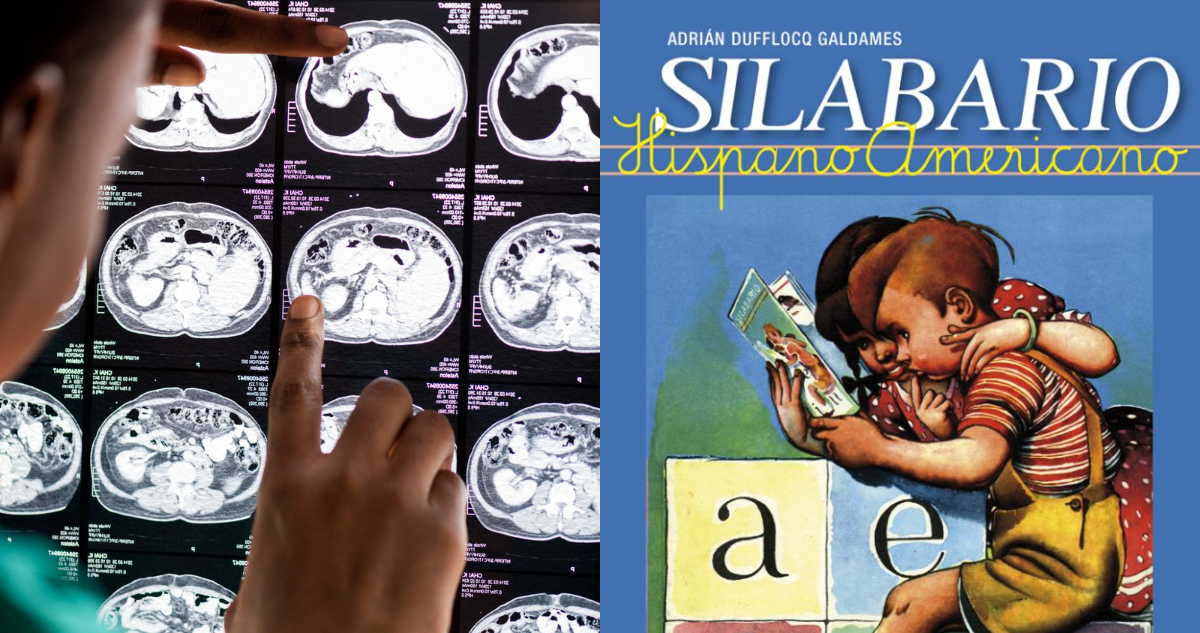 Médico analizando un escanner de cerebro (izquierda) y una fotografía del libro “silabario” en referencia al estudio que señala que el idioma repercute en el funcionamiento del cerebro(derecha)