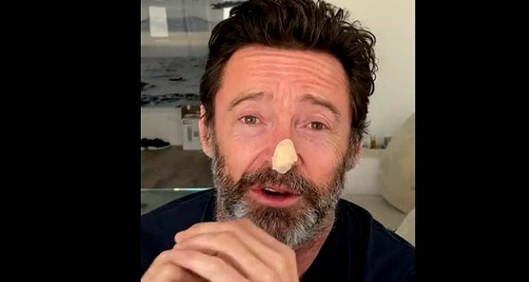 HUGH JACKMAN