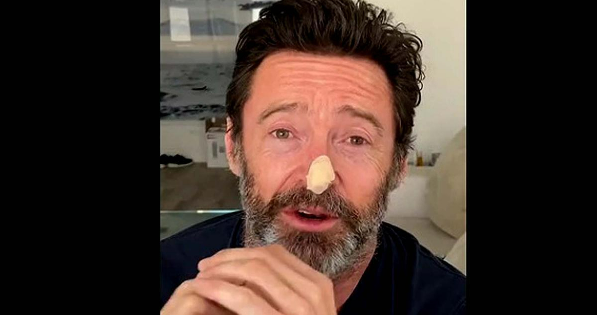 HUGH JACKMAN