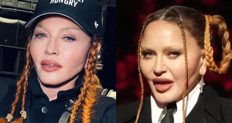 Madonna quiere volver a su rostro “natural”