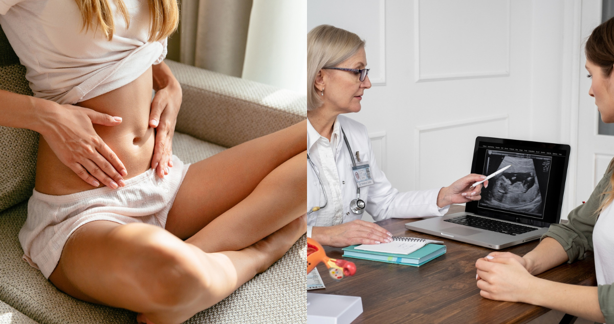 Mujer tocandose el abdomen (izquierda) y mujer en revisión médica de su útero (derecha) en referencia al prolapso uterino