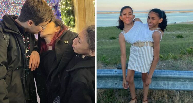 Las siamesas Carmen y Lupita Andrade respondieron la pregunta que más les hacen en redes sociales “¿Cómo tienen sexo?”