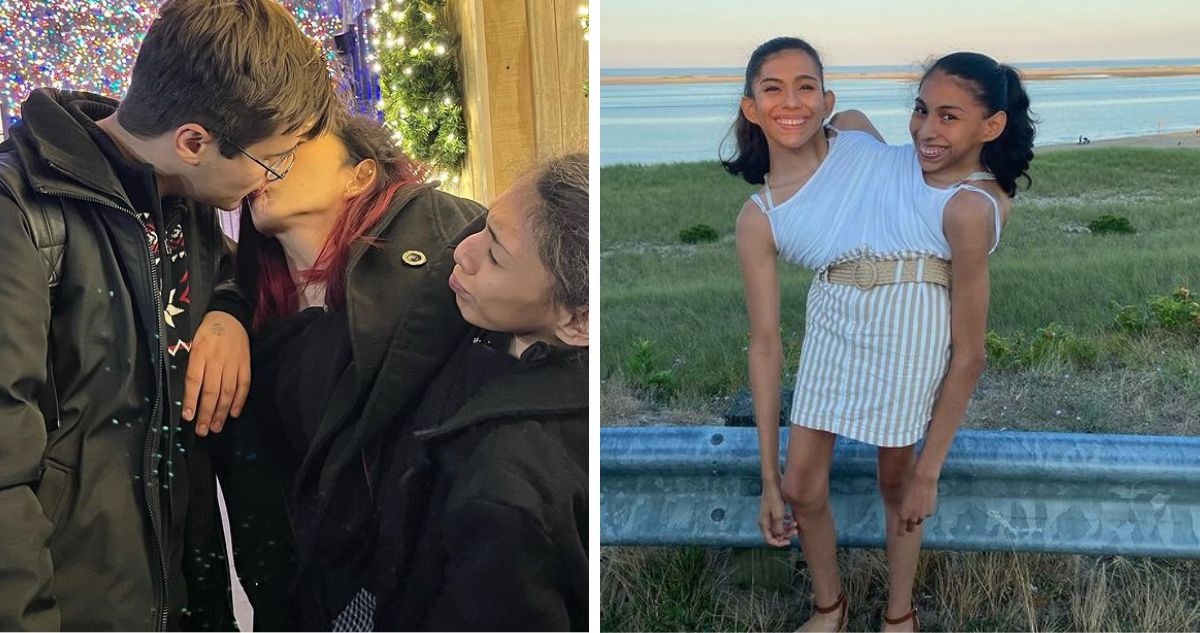Las siamesas Carmen y Lupita Andrade respondieron la pregunta que más les hacen en redes sociales “¿Cómo tienen sexo?”