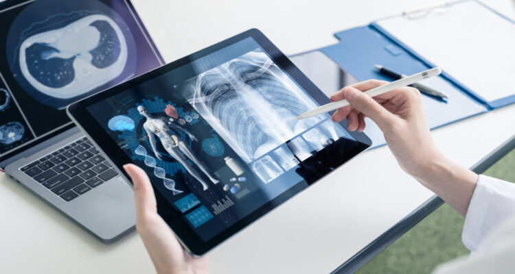 Secuenciación NGS: la técnica que puede identificar causas de cáncer