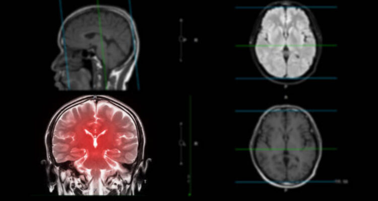Batería implantable para eliminar tumores