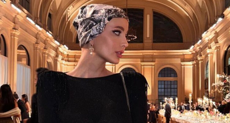 Aylén Milla mira hacia un costado posando. La influencer relató cuál fue su primer síntoma de cáncer y admitió que lo ignoró por meses.