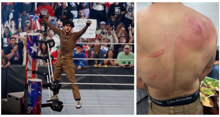 Una fotografía de Bad Bunny en el ring, y otra de su espalda tras la pelea.