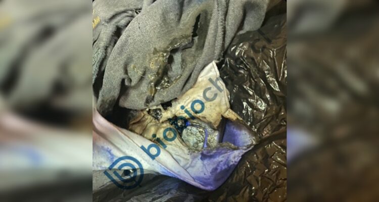 Escolar termina con lesiones en Santiago: su celular entró en combustión en plena sala de clases