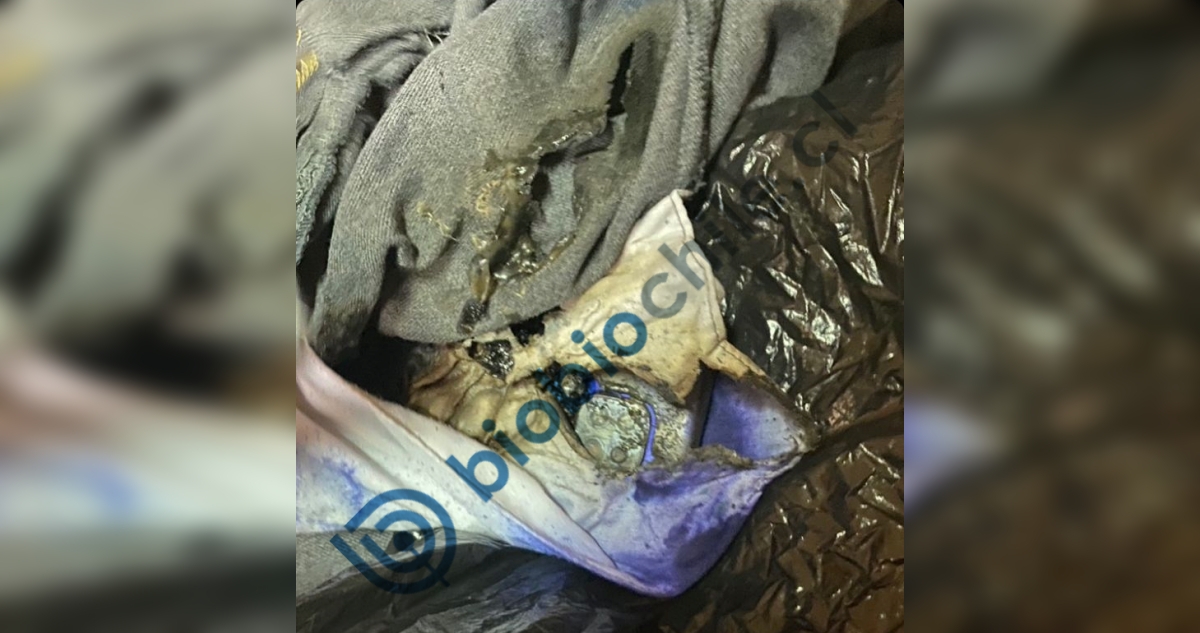 Escolar termina con lesiones en Santiago: su celular entró en combustión en plena sala de clases