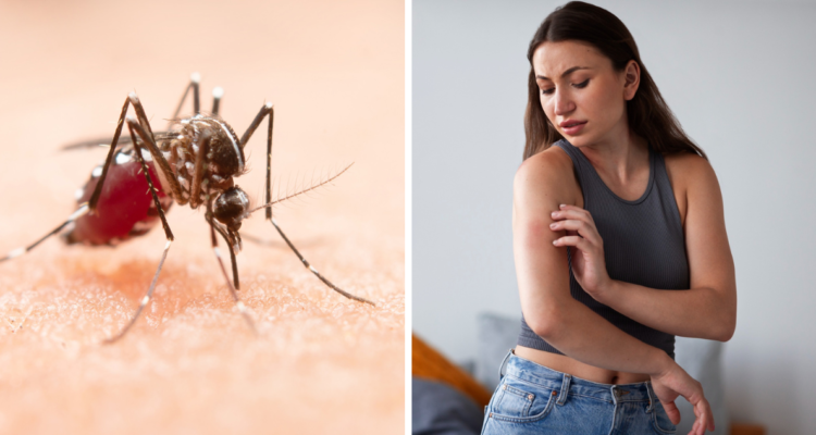 Mosquito (izquierda) y una mujer picada por uno (derecha) en referencia al virus del dengue transmitido por estos insectos