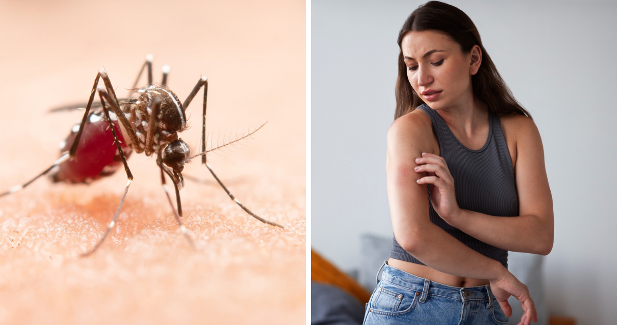 Mosquito (izquierda) y una mujer picada por uno (derecha) en referencia al virus del dengue transmitido por estos insectos