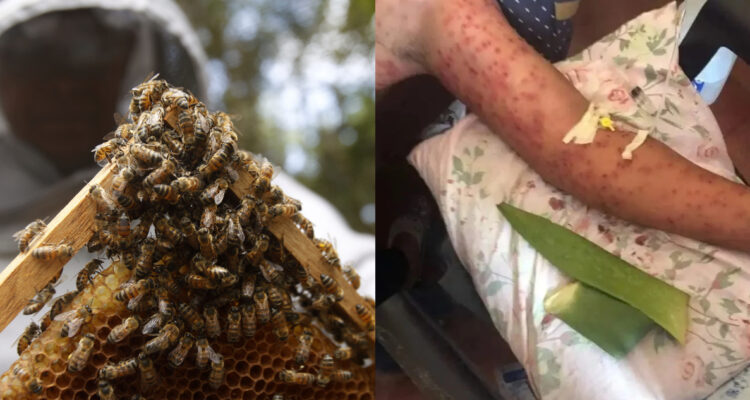 Enjambre de abejas africanas mata a seis personas