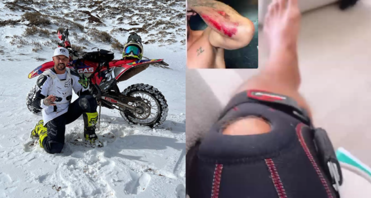 Fabricio Vasconcelos en su moto (izquierda) y post accidente en moto (derecha)