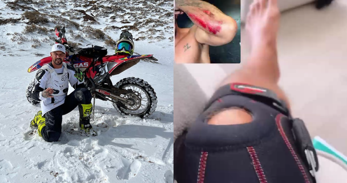 Fabricio Vasconcelos en su moto (izquierda) y post accidente en moto (derecha)