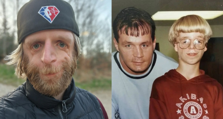 Jono Lancaster, paciente de síndrome de Treacher Collins que se convirtió en coach motivacional