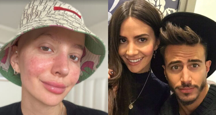 Marco Ferri junto a Aylén Milla cuando eran pareja. A su lado, la foto más reciente de Milla tras contar que tiene cáncer.