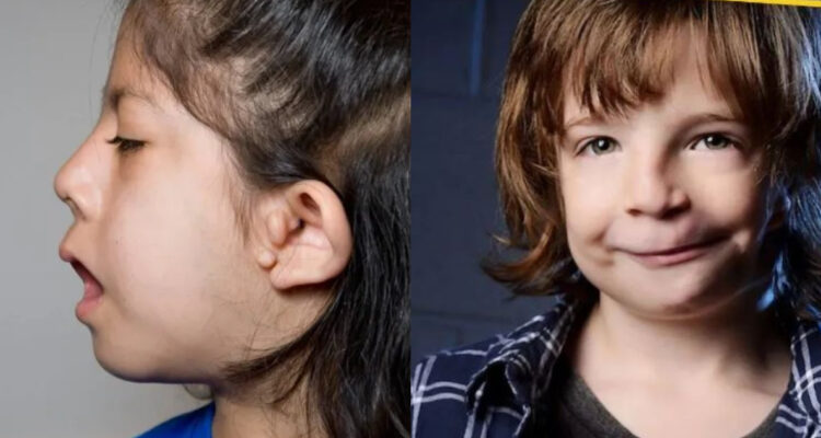 síndrome de Goldenhar