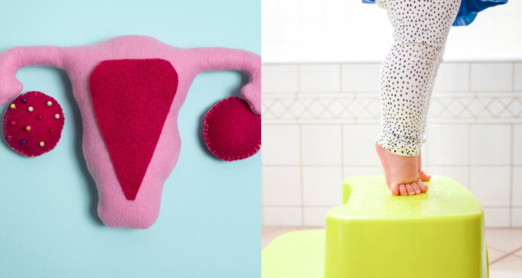 Ilustracion de ovario poliquístico (izquierda) y niño con obesidad infantil (derecha)