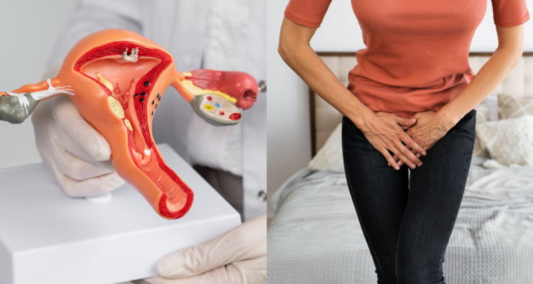 Modelo 3D de útero (izquierda) y mujer con incontinencia urinaria (derecha) en referencia a la vaginoplastía