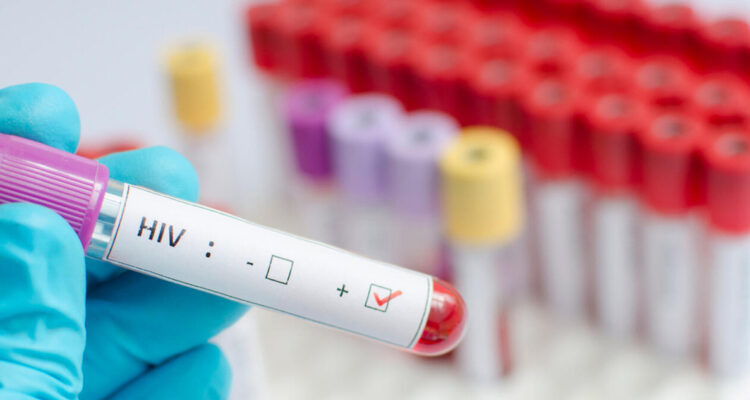 Imagen contextual sobre VIH y posibles nuevos tratamientos.