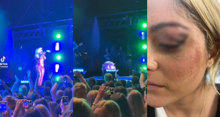 Capturas de TikTok donde se ve el golpe a Bebe Rexha (izquierda) y una fotografía de la propia artista donde muestra las heridas (derecha)