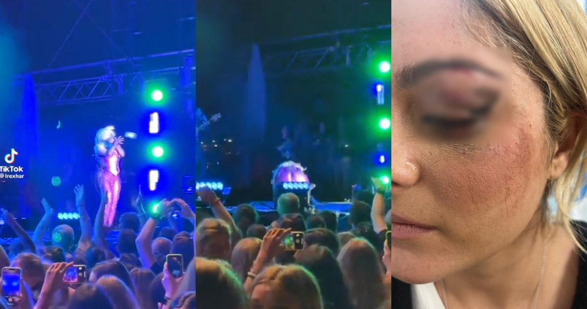 Capturas de TikTok donde se ve el golpe a Bebe Rexha (izquierda) y una fotografía de la propia artista donde muestra las heridas (derecha)