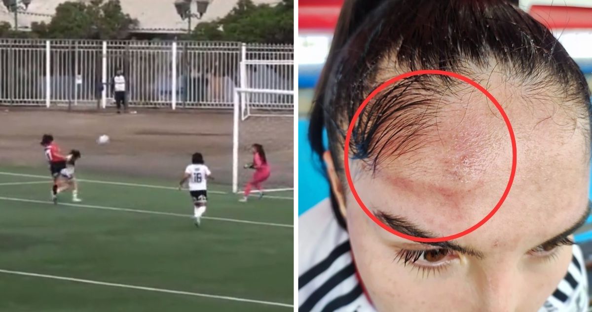 Javiera Grez denunció el “vergonzoso” arbitraje que tuvo el duelo entre Deportes Antofagasta y Colo Colo.