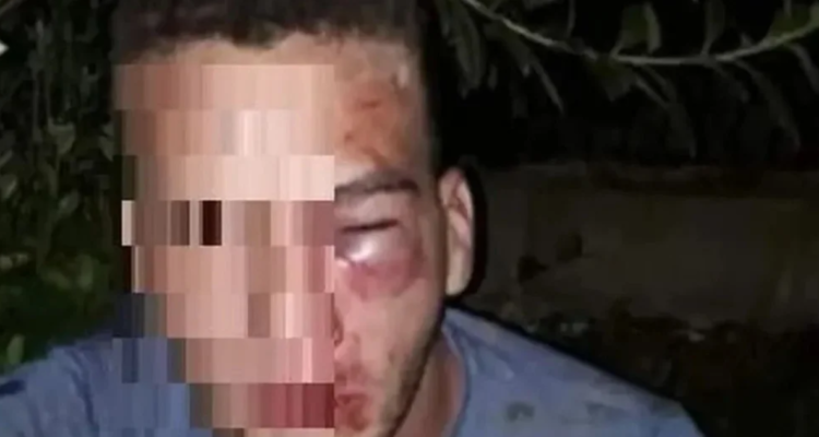 Argentino desfigurado a golpes: pactó encuentro con niña de 12 años, pero una madre lo anticipó