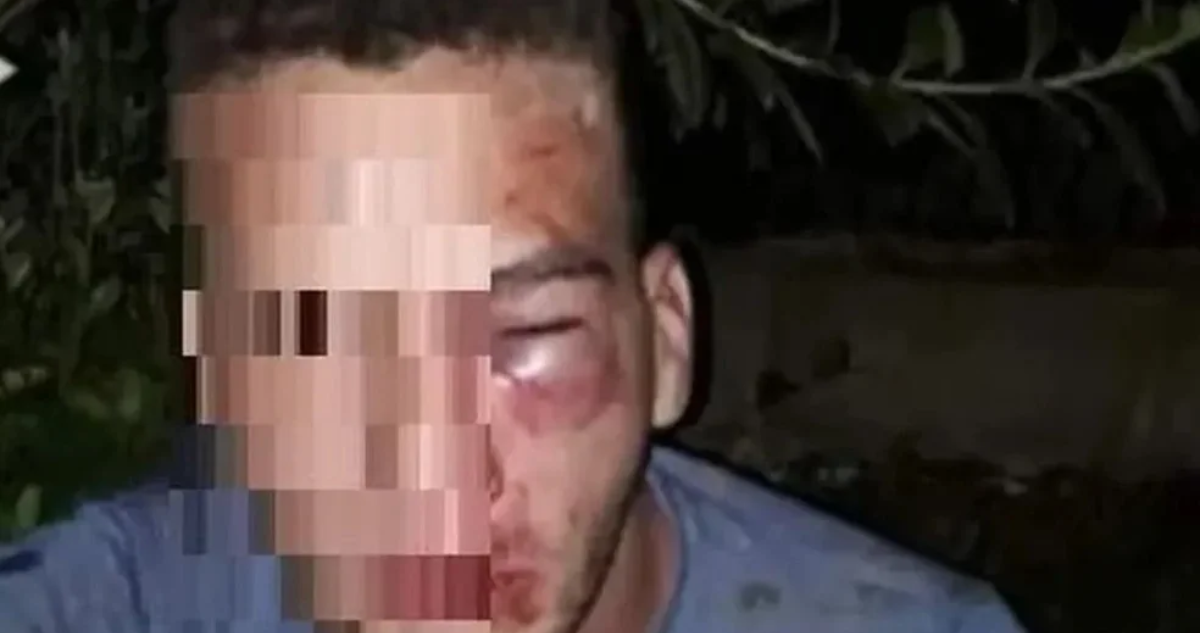 Argentino desfigurado a golpes: pactó encuentro con niña de 12 años, pero una madre lo anticipó