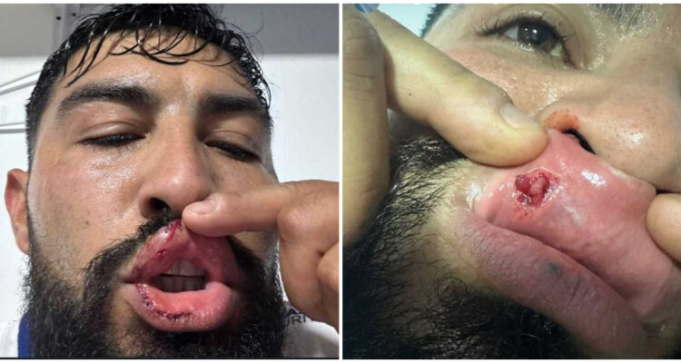 Nicolás Maturana Instagram