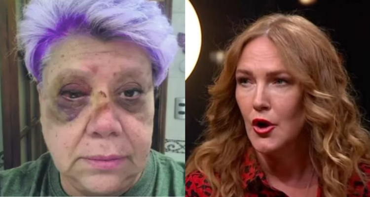 Paty Maldonado tras accidente