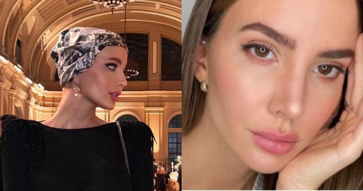 Aylén Milla no podría ser madre