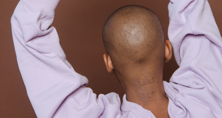 derecho al olvido oncológico