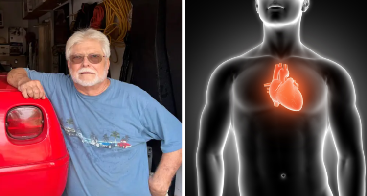 Gary Wingfield, hombre al que el corazón se le desplazó al lugar del pulmón (izquierda) e ilustración del lugar donde debía estar (derecha)