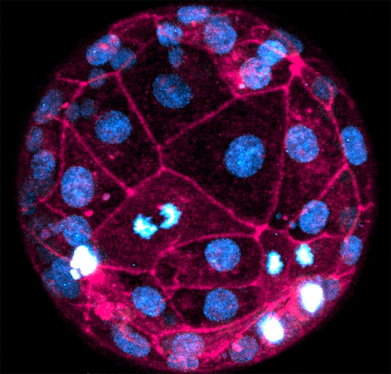 Científicos logran tomar las imágenes más nítidas de embriones humanos en desarrollo 