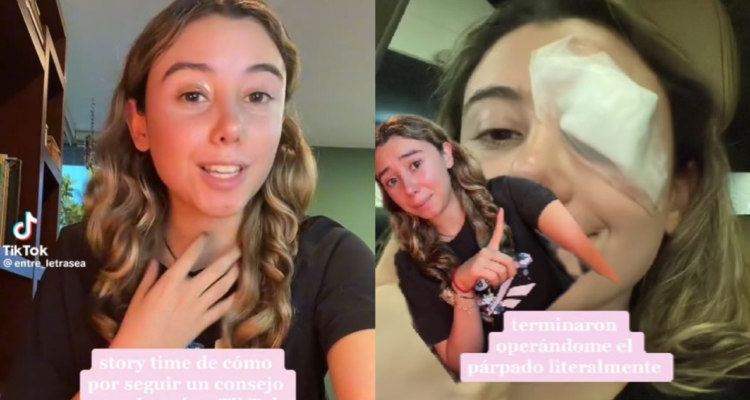 Joven fue operada tras seguir truco de TikTok