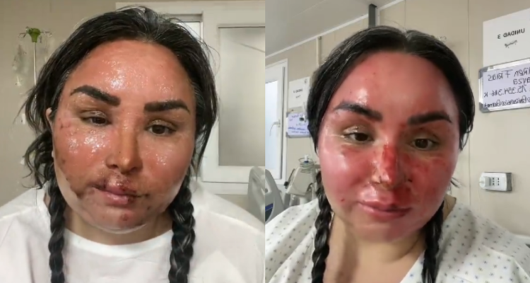 Recuperación de Karencita Frías