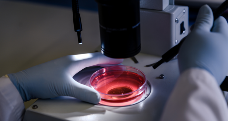 Células CAR-T : nuevo avance para tratar el cáncer