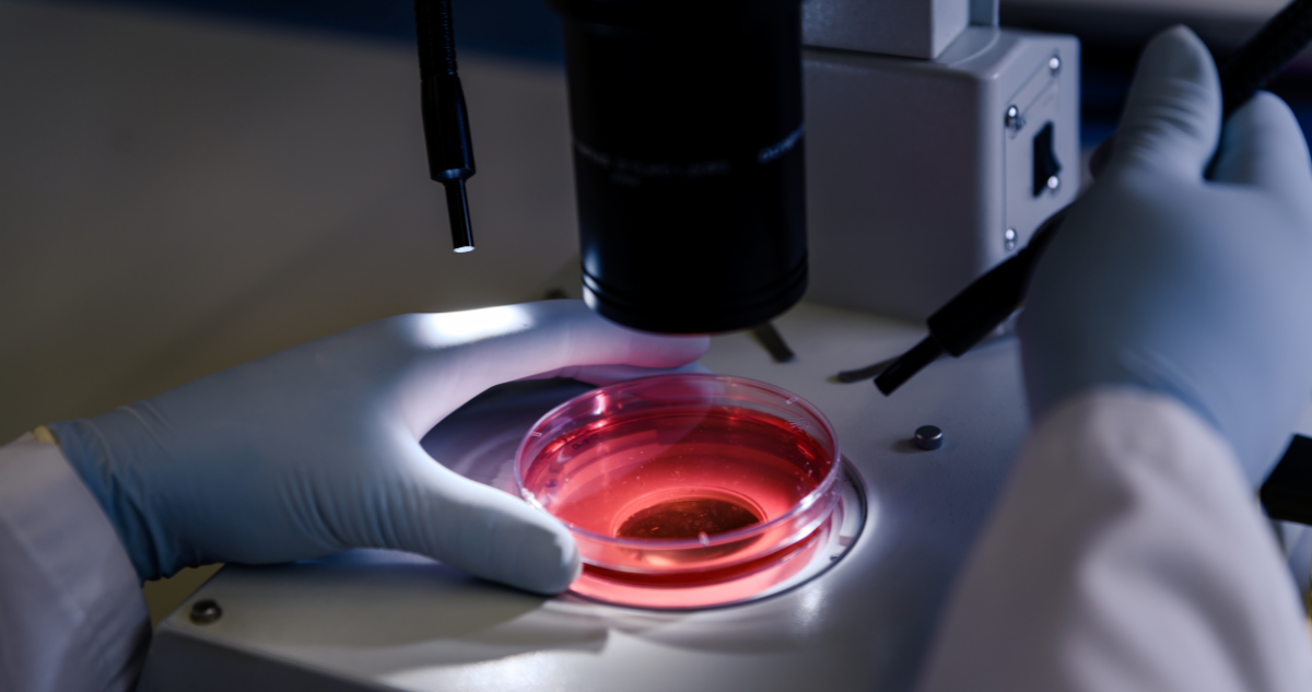 Células CAR-T : nuevo avance para tratar el cáncer