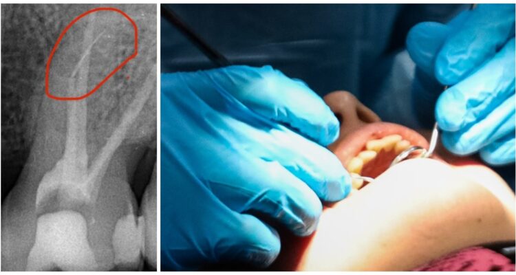 Cedida a RBB – CONTEXTO | Agencia UNO