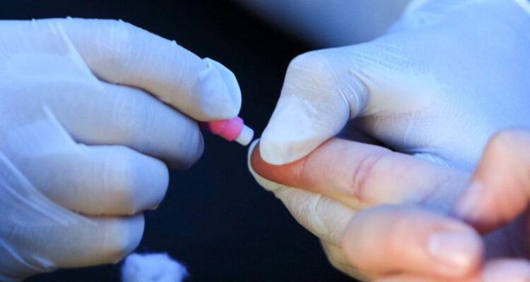 ISP: casos de VIH positivo aumenta 7% en un año y mayor tasa de diagnóstico está asociada a hombres