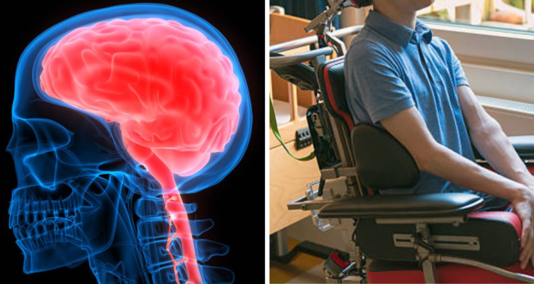 Hombre con parálisis logra comunicarse y acceder a internet gracias a implante en su cerebro