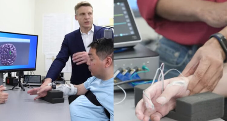 Restablecen parcialmente la movilidad de un hombre tetrapléjico mediante microchips cerebrales con IA