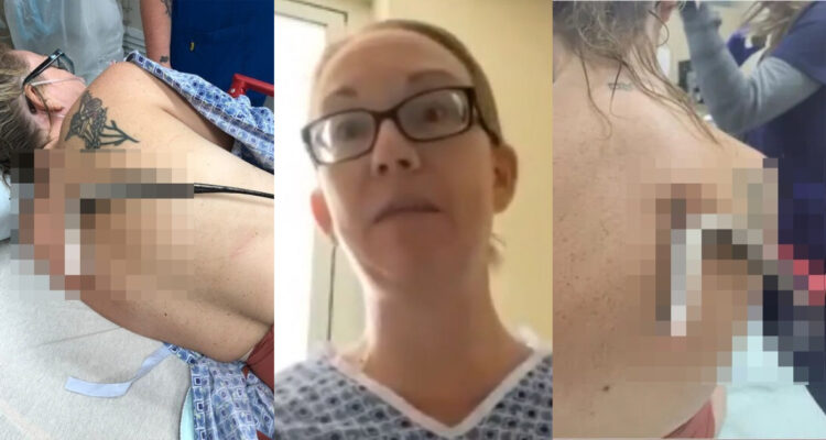 Mantarraya atacó la espalda de una mujer