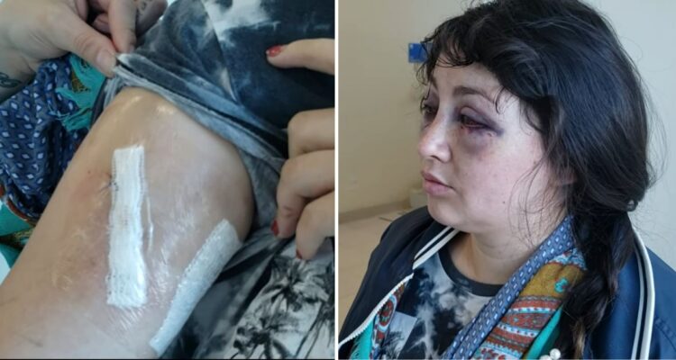“Recibí sus puñaladas”: Mujer relata ataque de su pareja estando con su bebé de un año en brazo