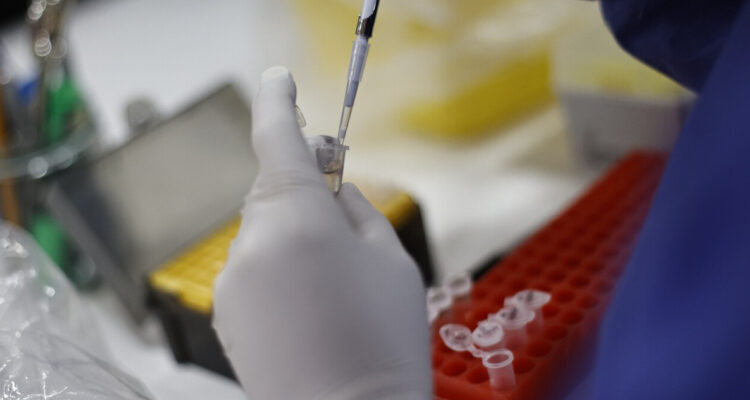 Seremi de Salud confirma caso importado de sarampión en la región Metropolitana