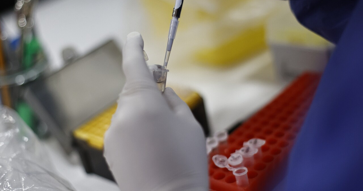 Seremi de Salud confirma caso importado de sarampión en la región Metropolitana