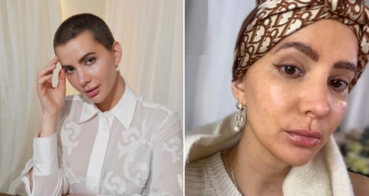 Complicación de Aylén Milla