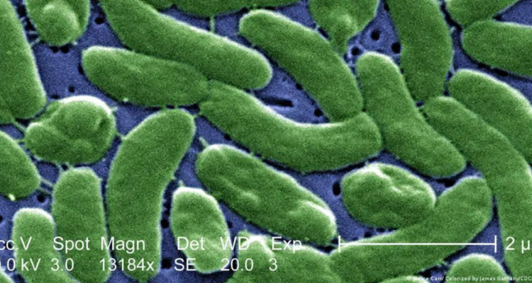 Elevan alerta en Estados Unidos por aumento de casos de infección por “bacteria carnívora”