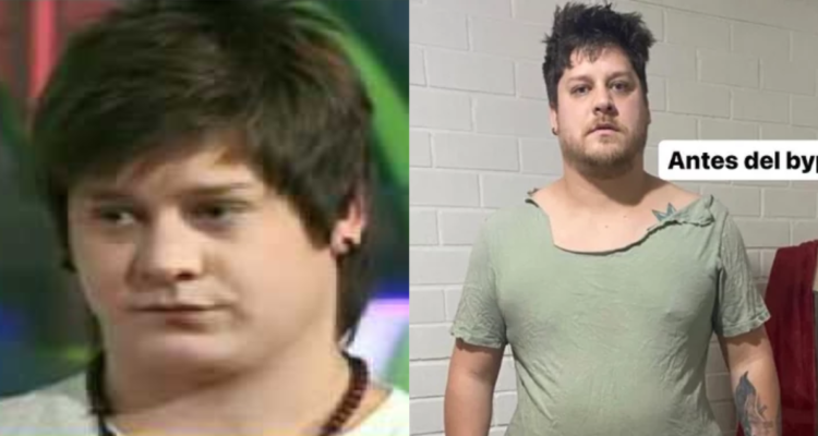 Exchico Yingo se somete a bypass por Bono PAD: ha bajado 30 kilos. ¿Cómo funciona esta modalidad?